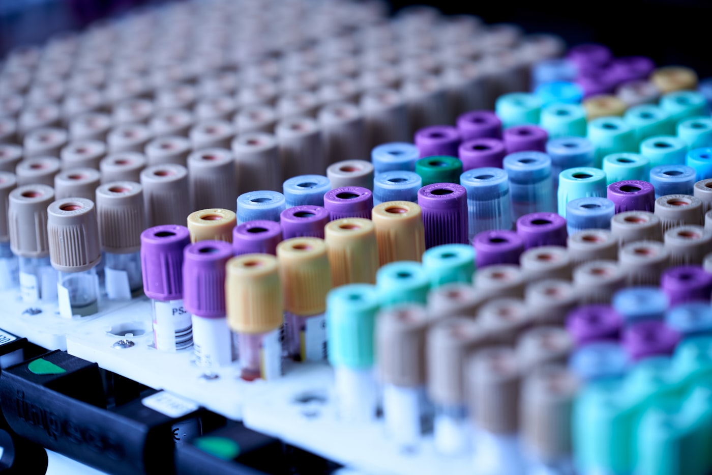 PRP injections Winnipeg using a patient's blood sample