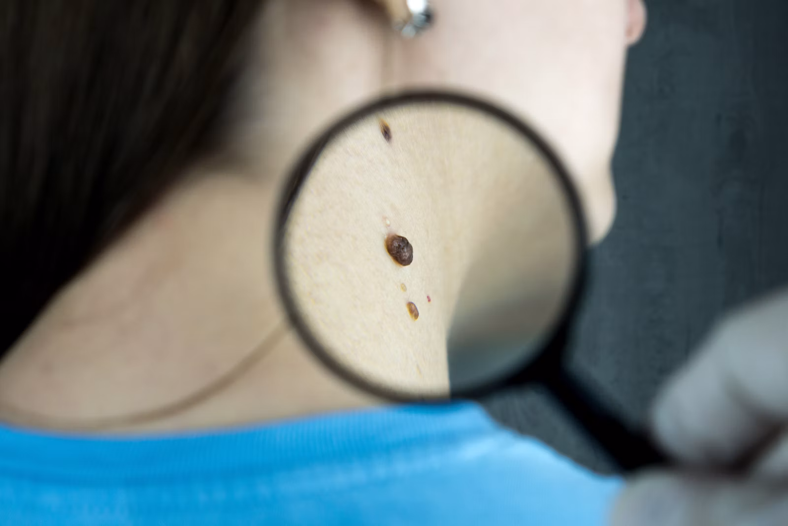Skin assessment at a Winnipeg medical clinic